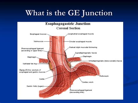 what is ge junction cancer